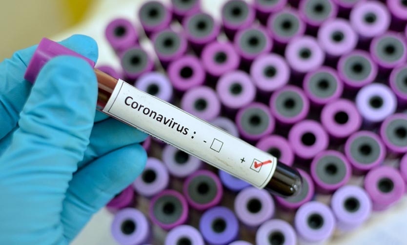 Coronavirus: Pilar, la Comuna de la región que más casos de transmisión local tiene