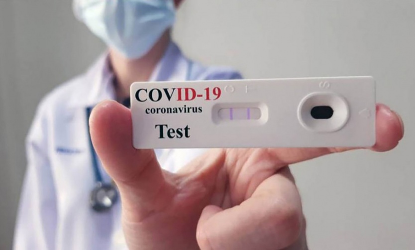 El resultado de los autotest de coronavirus se deberá notificar a las farmacias